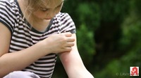 Wenn’s sticht, brennt oder beißt: Die richtige Hilfe zur richtigen Zeit